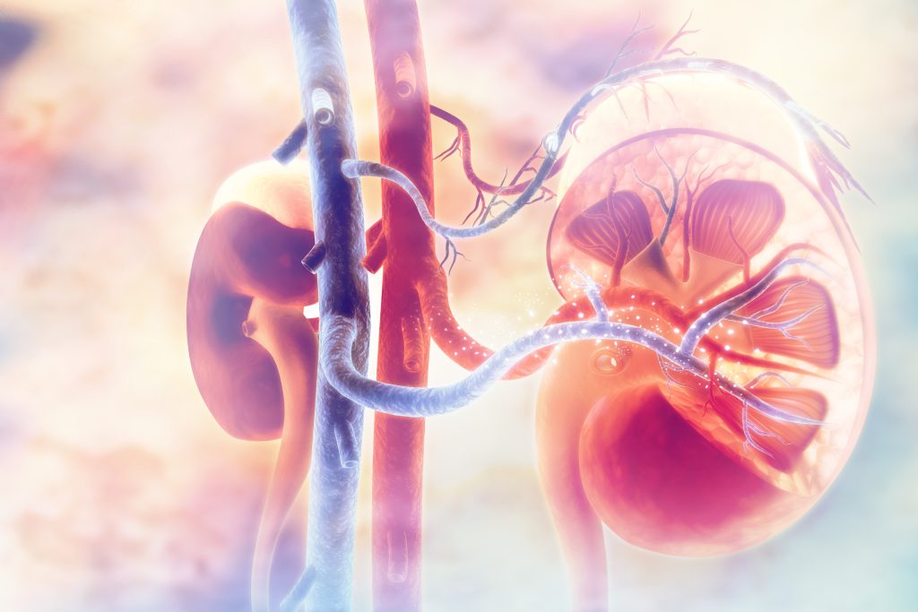 calciphylaxis patient education