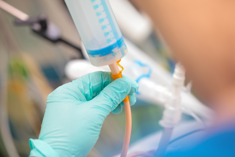 Nurse checking gastric residual volume for a tube fed patient