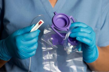 overfeeding in the ICU
